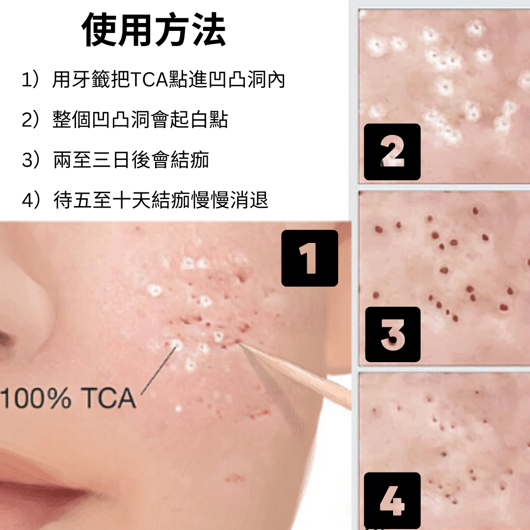TCA 使用方法